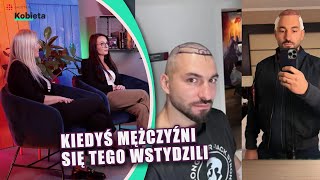 Polacy masowo przeszczepiają włosy w Turcji Dlaczego „Wynika to z ich niewiedzy” MAMY CZAS [upl. by Polly684]