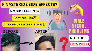 FINASTERIDE No SIDE EFFECTS  RESULTS and experience [upl. by Onileva]