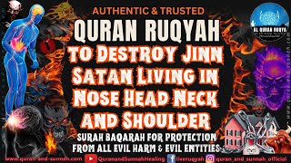 Strong Ruqyah to Destroy Jinn Living in Nose Head Neck and Shoulder  Surah Baqarah for Protection [upl. by Akinej]