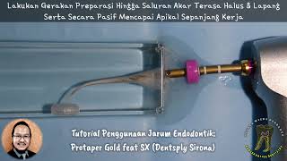 Tutorial Jarum Endodontik ProTaper Gold feat SX Dentsply Sirona [upl. by Buchheim350]