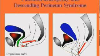 Anatomy of the pudendal nerve diagnosis and causes of pudendal neuropathy [upl. by Hceicjow]