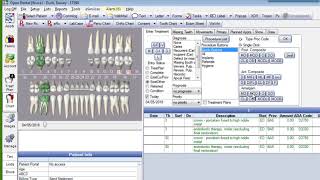 Entering Treatment Plans in Open Dental [upl. by Neleh]