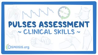 Clinical Skills Pulses assessment [upl. by Llennol]