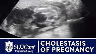 Cholestasis of Pregnancy Treating Itchy Hands amp Preventing Still Birth  SLUCare OBGYN [upl. by Arvonio]