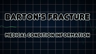 Bartons fracture Medical Condition [upl. by Ebeohp]