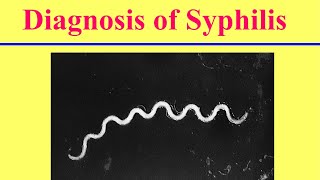 التشخيص المعملى لمرض الزهري ‏Lab Diagnosis of Syphilis [upl. by Page797]