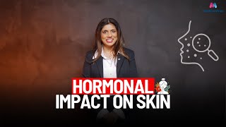 The Impact of Hormones on Your Skin  Dr Sue [upl. by Fortin]