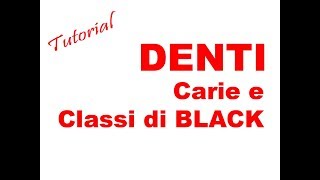 METASALUTE tutorial DENTI  carie e classi di black [upl. by Ayocal]