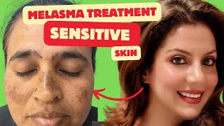 Melasma Treatment for Sensitive skin  Melasma Skincare Routine  Nipun Kapur [upl. by Oramlub]