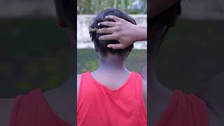 Neck Cleaning Tips  Dark Neck Remove Home RemediesGet Rid Of Dark Neck dark shorts viralvideo [upl. by Akihsat]