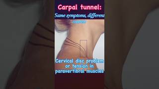 Cervical disc problem or tension in paravertebral musclescervical cervicalpain pain excrises [upl. by Paik]