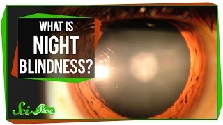 What Is Night Blindness [upl. by Egroj]