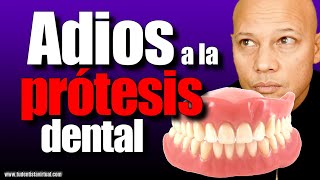 LA MEJOR FORMA de REEMPLAZAR TU PROTESIS DENTAL sin TENER MUCHO HUESO en las ENCÍAS [upl. by Staley]