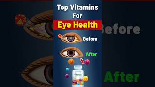 Essential Vitamins For Fighting Dry Eye Disease Cataracts amp AgeRelated Macular Degeneration [upl. by Lionel189]