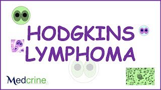 Hodgkins Lymphoma Pathophysiology symptoms and treatment [upl. by Hpeseoj]