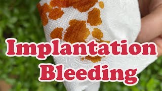 implantation bleeding pregnancy ✔️ Heres everything to know about it [upl. by Pirnot]