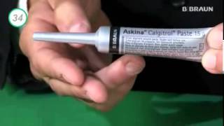 Askina® Calgitrol® Apósito estéril para el cuidado de heridas [upl. by Itin]