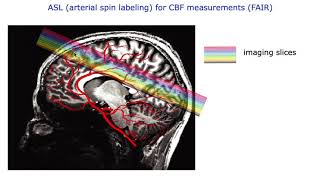 Renzo Huber Comment on nonBOLD fMRI vs BOLD fMRI [upl. by Oinolopa932]