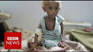 Yemen On the brink of starvation  BBC News [upl. by Muna480]