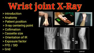 Wrist Joint Xray  Wrist PA  Lateral  Oblique view Upper limb radioy   By BL Kumawat [upl. by Seldun579]