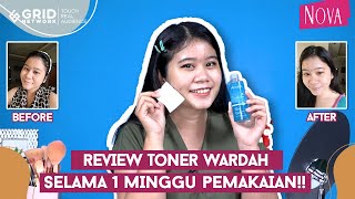 Review Wardah Acnederm Pore Refining Toner di Kulit Kering dan Berjerawat [upl. by Timofei926]