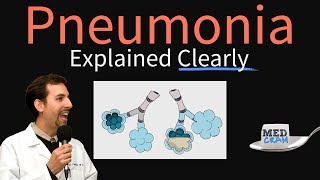 Pneumonia Explained Clearly by MedCramcom [upl. by Janean105]