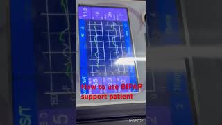 How to use bipap machine  BIPAP support icu patient  BIPAP setup icu patient  bipap shorts [upl. by Eelarat313]