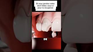 Processus de réparation dune dent shortvideo sciencepopulaire shorts dentist shortviral [upl. by Wendalyn158]