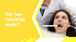 Diş Taşı Temizliği Nedir Diş Taşı Temizliği Acıtır Mı [upl. by Amahs]