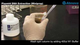 Plasmid DNA Extraction Miniprep [upl. by Tarryn]