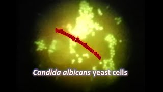 Candida albicans under Fluorescence microscope stained with Acridine Orange [upl. by Akli]