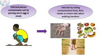 Why do my child get worms and how to prevent it  National Deworming Day Feb 10 [upl. by Archer357]