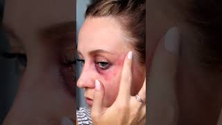 Mehron Makeup Special FX  Bruises and Cuts [upl. by Flemming]