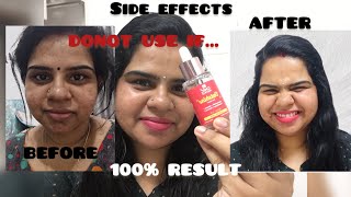 ഒരു GLASS SKIN കഥ😳 CHICNUTRIX outshine serum honest REVIEW amp DEMO whiteningserum chic glassskin [upl. by Pucida]