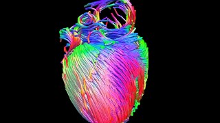 MRI diffusion tensor imaging of the heart [upl. by Ifill]