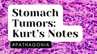 Stomach Tumors Kurt’s Notes pathagonia [upl. by Negroj]