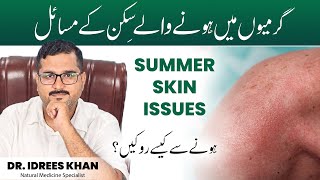 Common Summer Skin Problems  Garmi Ke Mausam Men Skincare Heat Rash Treatment  Body Sweat Control [upl. by Julius448]