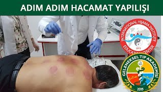 Hacamat Sırları3 Ön Vakumlama incelikleri DrN Süleyman Gök [upl. by Lunn]