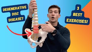 3 Best Exercises for Degenerative Disc Disease [upl. by Nonah]