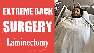 Laminectomy Decompression Surgery [upl. by Guise509]