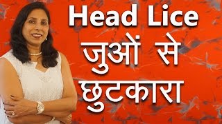 जुओं से छुटकारा कैसे पाएं  How to remove Head Lice with Home Remedies  Ms Pinky Madaan [upl. by Gine858]