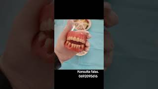 Punime te kombinuara goviral dentist dentalclinic smile dentistry veneers [upl. by Devaney26]