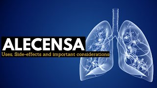 Alecensa Targeted Therapy for ALKPositive Lung Cancer [upl. by Izawa71]