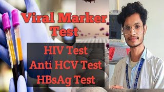 What is viral marker test how to do viral marker test HIVAIDSanti HCVHBsAg Hepatitis BampC [upl. by Stilu766]