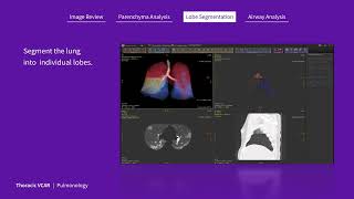 Thoracic VCAR animation [upl. by Natie]