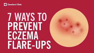 7 Ways to Prevent Eczema FlareUps [upl. by Demmahum]