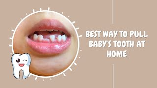 How To Pull Baby’s Tooth at Home [upl. by Thistle757]