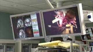 Awake Craniotomy at BarnesJewish Hospital [upl. by Ellednek]