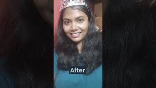 Miduty Success Story  Sejal Meshram BeforeAfter Acne Free face miduty midutysuccessstory [upl. by Malley]