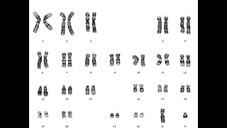 Karyotyping Human chromosome identificationeasiest way of making KaryogramCytogenetic analysis [upl. by Isayg]